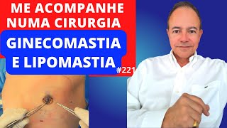 Venha ver uma cirurgia de GINECOMASTIA e LIPOMASTIA Dr Jacintho  Cirurgião Plástico [upl. by Gney]