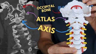 Atlantoaxial and Atlantooccipital Joints  C1 amp C2 Atlas and Axis  Radiology Anatomy Part 1  CT [upl. by Hulbig489]