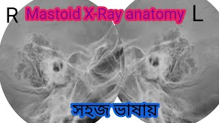 Mastoid XRAY Anatomy in Bengali  How to read mastoid Xray [upl. by Malamut668]