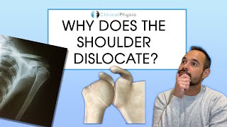 Why The Shoulder Joint Dislocate So Easily  Expert Physio Guide with 3D Anatomy Tutorial [upl. by Yddeg]