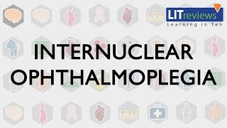 Internuclear Ophthalmoplegia [upl. by Anak643]