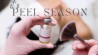 Its Peel Season What are Chemical Peels and are they for you [upl. by Fina]