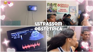 vendo baby pela primeira vez ultrassom obstétrica 💙🩷 [upl. by Doersten]