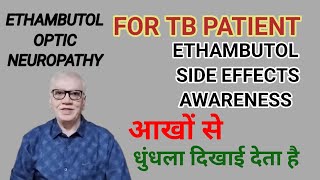 टीबी की दवा और आखो से कम दिखाई देनाETHAMBUTOL TOXICITY SIDE EFFECTS OF ETHAMBUTOL [upl. by Alleunam]