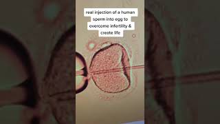 Real injection of sperm into a human egg to create a new life [upl. by Ody]