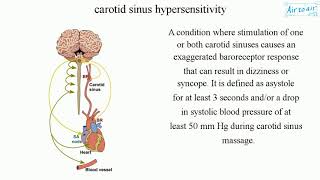 carotid sinus hypersensitivity [upl. by Alrzc]