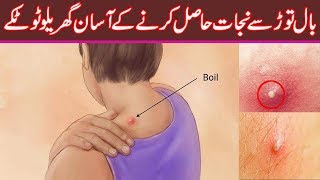 How To Get Rid Of Boils Overnight  Natural Treatment At Home  Bal Tor ka Ilaj [upl. by Sedda]