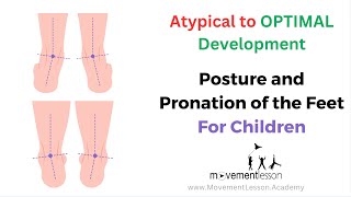 Atypical Development Baby Posture and Pronation of the Feet [upl. by Acimad657]