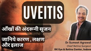 UVEITIS यानी आँखों की अंदरूनी सूजन जानिये इसके बारे में सब कुछ [upl. by Erskine]