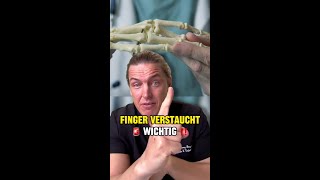 🚨 Verstauchter Fingers – Was tun Hier sind deine Schritte [upl. by Kinchen584]