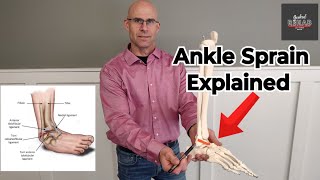 Ankle Sprains 101 Understanding the Most Commonly Affected Ligaments With Dr Monte anklepain [upl. by Tarrance]