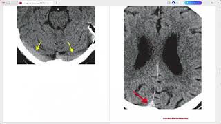 EMERGENCY RADIOLOGY COFFEE CASE BOOK [upl. by Niras]