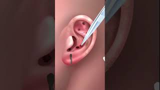 Cleaning Your Ears An ASMR Experience  asmr satisfiedasmr earcleaningasmr [upl. by Yetti]