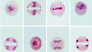 MEIOTIC CELL DIVISION STAGES OF EASTER LILY Lilium longiflorum [upl. by Lenoj]