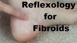 Reflexology for Fibroids  Massage Monday 274 [upl. by Matteo]