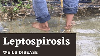 Leptospirosis  Weils Disease [upl. by Jessi]