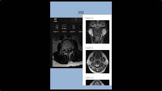 RADIOLOGY EXAM CASES [upl. by Yenruoj]