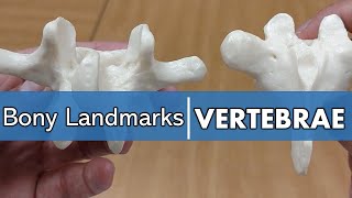 Bony Landmarks of the Vertebrae [upl. by Dirraj]