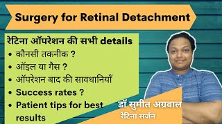 Surgery for Retinal Detachment क्या होता है रेटिना की सर्जरी में  जानिये ऑपरेशन की सभी details [upl. by Othello]