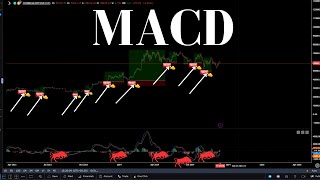 Does MACD Works [upl. by Samara]