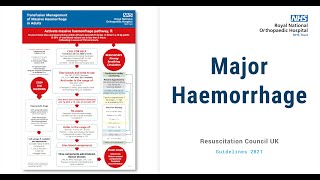 Major Haemorrhage SBAR handover [upl. by Pudendas]