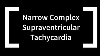 Narrow Complex Supraventricular Tachycardia [upl. by Sadnalor]