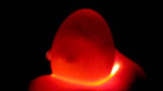 Candling Chicken egg at 10 days [upl. by Airtal344]