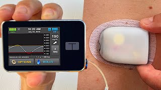 Omnipod 5 vs Tandem tslim x2  Full Test amp Review [upl. by Pare]