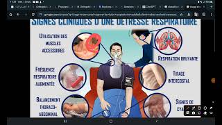 UE1 Sémiologie respiratoire  Les Signes fonctionnels Part 1 La Dyspnée [upl. by Nemaj]