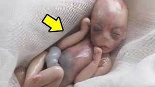 🛑The stillborn baby left everyone shocked😱 [upl. by Bernette]