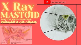 X Ray Mastoid Bone behind the ear in urduhindi कर्णमूल [upl. by Lilhak179]