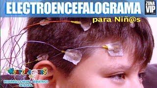 ELECTROENCEFALOGRAMA PARA NIÑS [upl. by Lexis]