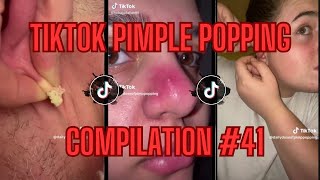 How Did A Pimple Get In There  TikTok Pimple Popping Compilation 41 [upl. by Roseanne]