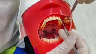 Scaling Teeth Manual amp Type Of Rest شرح بالتفصيل [upl. by Nic]