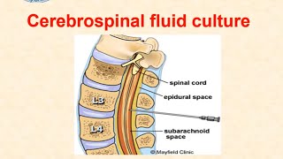 Cerebrospinal fluid culture  dr Ismail [upl. by Ennaid851]