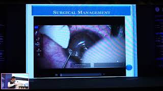 CASE BASED LEARNING IN REFRACTIVE SURGERY BY DR RAJESH SINHA [upl. by Nabru]