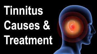 What is Tinnitus Causes amp Treatment Strategies [upl. by Pol]