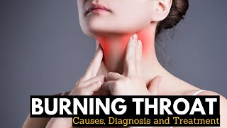 What Causes Burning Throat and its Treatment [upl. by Nanji]