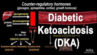 Diabetic Ketoacidosis DKA Pathophysiology Animation [upl. by Adalai3]