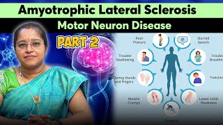 Amyotrophic Lateral Sclerosis  Motor Neuron Disease  Part 2  DR A VENI MD DM NEURO [upl. by Feirahs]