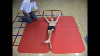 Dyskinetic cerebral palsy case 3 [upl. by Annalla]