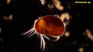 Ostracoda sp  Protozoans and other small critters [upl. by Trefler]