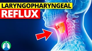 Laryngopharyngeal Reflux Medical Definition  Quick Explainer Video [upl. by Htide]