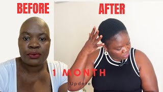 ONE MONTH HAIR UPDATE AFTER SHAVING MY HEAD BALD ❤️🫶 baldhead bigchop hairgrowthjourney [upl. by Murat]