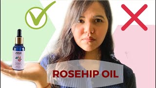 NYKAA ROSEHIP OIL  Benefits My experience Before and After Nykaa naturals essential oil range [upl. by Joli93]