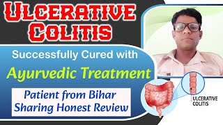 Ulcerative Colitis Ayurvedic Treatment Successfully Cured Patient From Bihar Sharing Honest Review [upl. by Lucien]