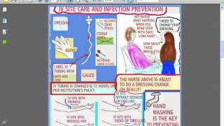 SESSIONS FOR NURSES 20 USE OF CENTRAL amp PICC LINES IV amp CENTRAL SITE CARE [upl. by Cynara]