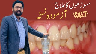 How to SWISH with SALT WATER to Cure Gum Disease Receding Gums and Gingivitis [upl. by Zeb527]