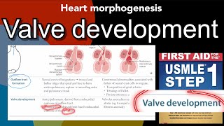 Valve development  heart morphogenesis in HindiUrdu by first aid for USMLE step 1 [upl. by Cristy720]