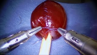 Da Vinci Surgical System Effortlessly Sutures Grape [upl. by Litton]